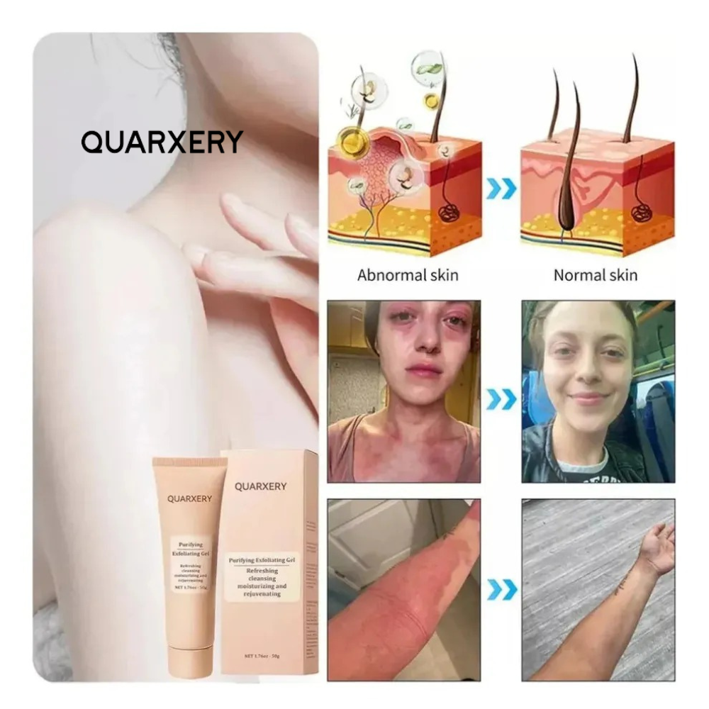 ✨ QUARXERY – Limpieza Profunda Que Renueva Tu Piel ✨