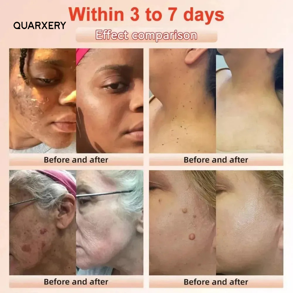 ✨ QUARXERY – Limpieza Profunda Que Renueva Tu Piel ✨